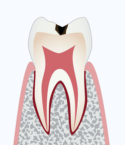 C1